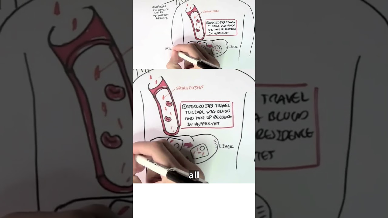 A tiny parasite with a complex journey — that’s Plasmodium at work 🦟🩸 #malaria #plasmodium #meded