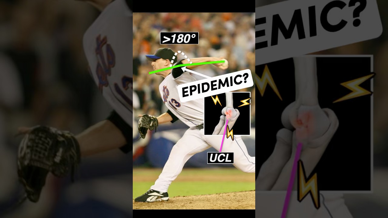 Why Tommy John Surgery Is SKYROCKETING (340% Increase Explained) — Part 1 #MLB #Baseball #Pitching