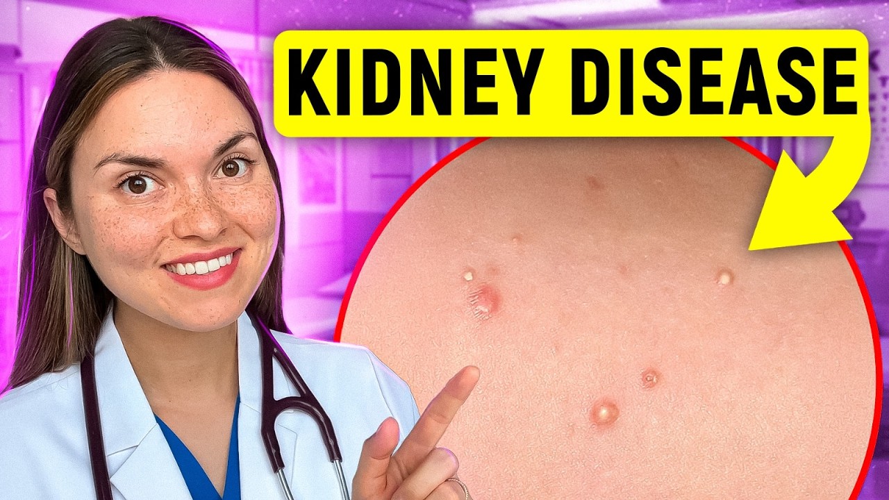 17 Signs of KIDNEY DISEASE You Can See: Doctor Explains