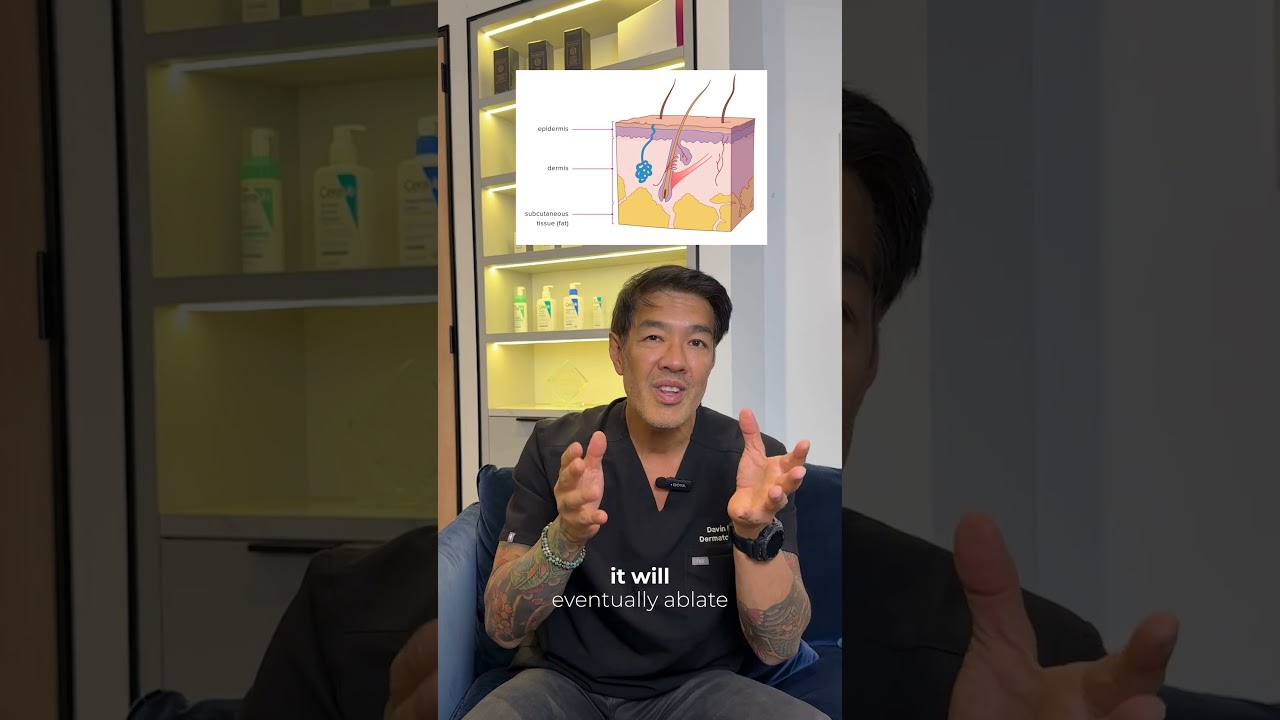 XERF vs Ultherapy