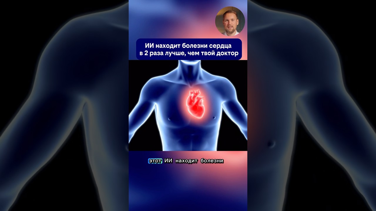 ИИ находит болезни сердца в 2 раза лучше чем твой доктор #ai #нейросети