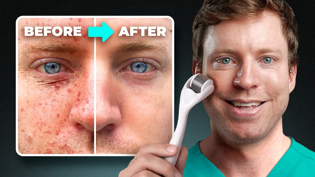 What Microneedling REALLY Does for Skin Aging