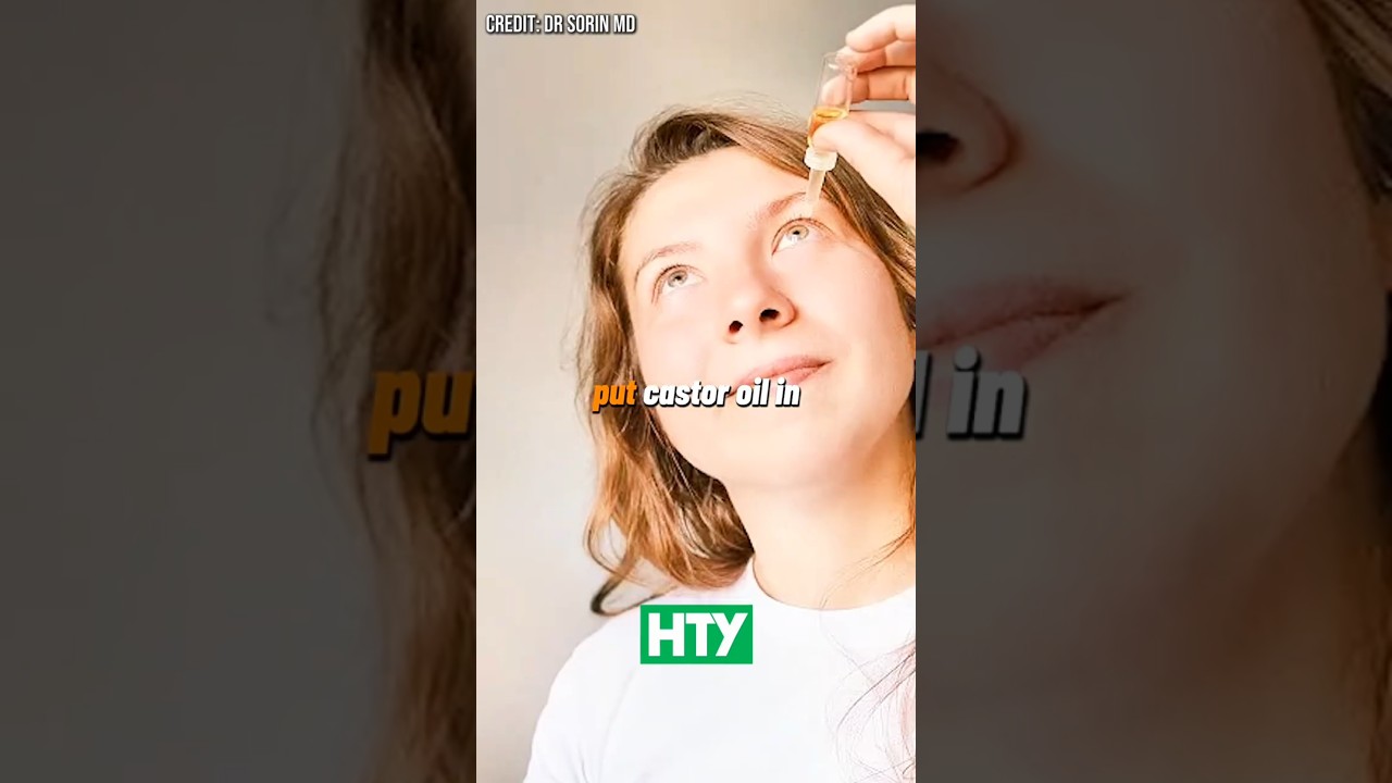 Can Castor Oil Really Remove Cataracts?