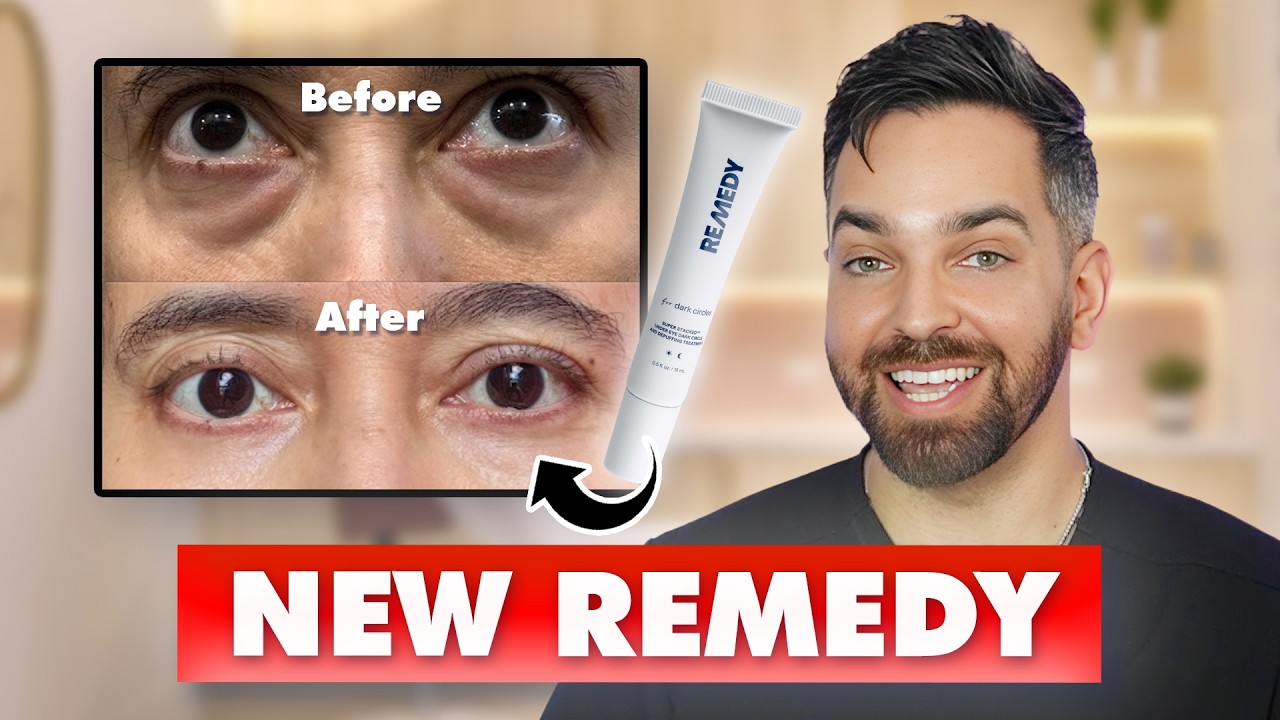 DARK CIRCLES & UNDER EYE BAGS? Introducing REMEDY for Dark Circles!