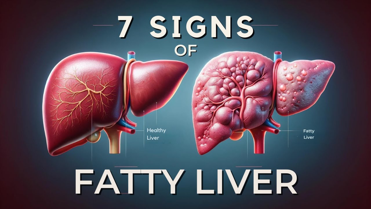 7 Early Warning Signs of Fatty Liver Disease Revealed