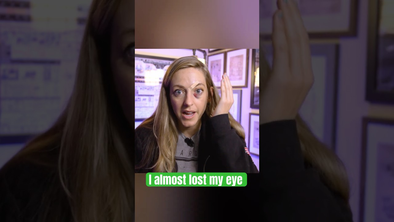 What happened to my face