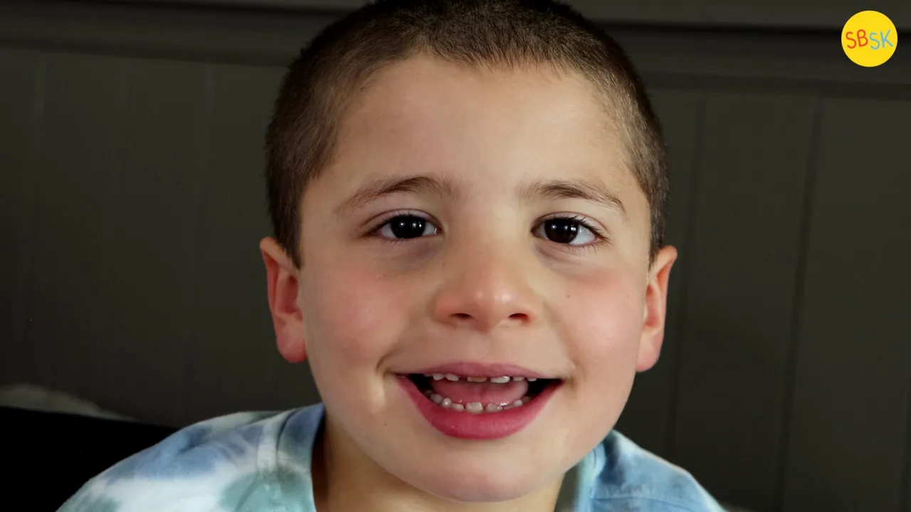 Living with 3 Rare Disabilities (Including 2 Genetic Deletions)