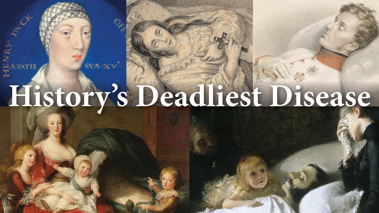 Royals who Died from Tuberculosis