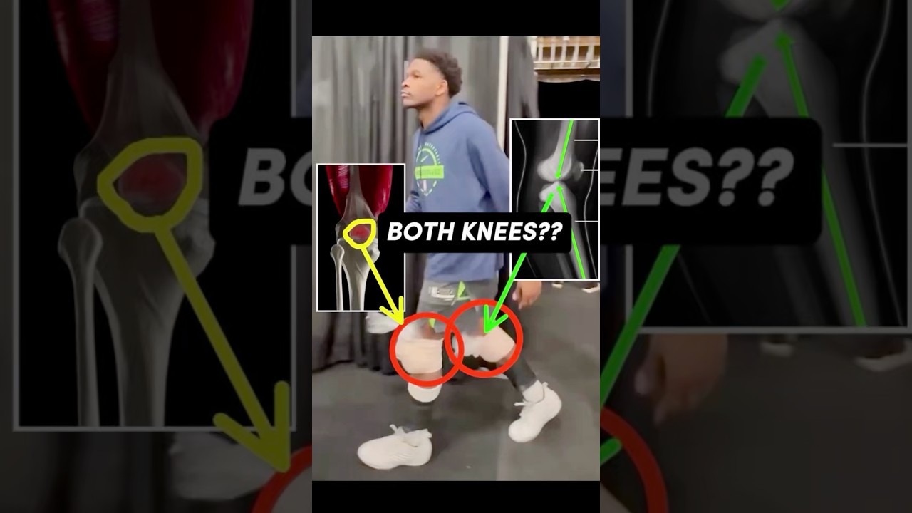 Anthony Edwards Has BOTH Knees Compromised… And is still dominating 4th quarters #NBAPlayoffs