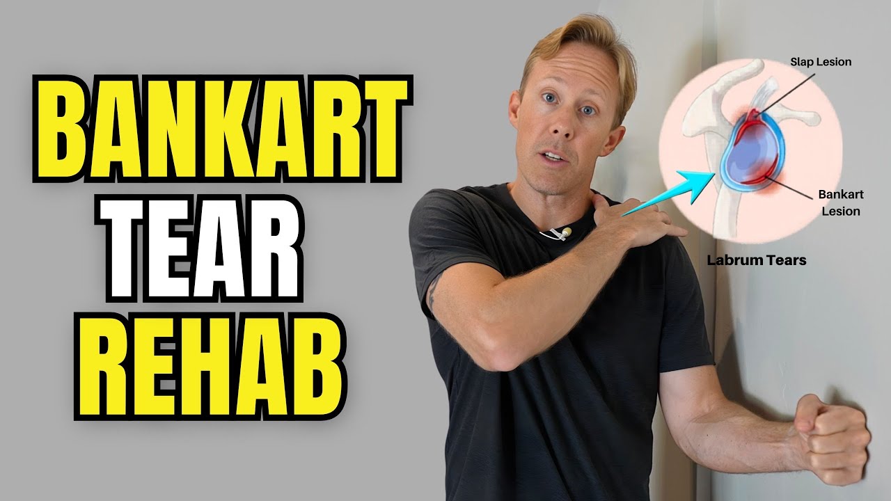 Bankart Lesion Rehab: 5 Exercises to Stabilize an Unstable Shoulder