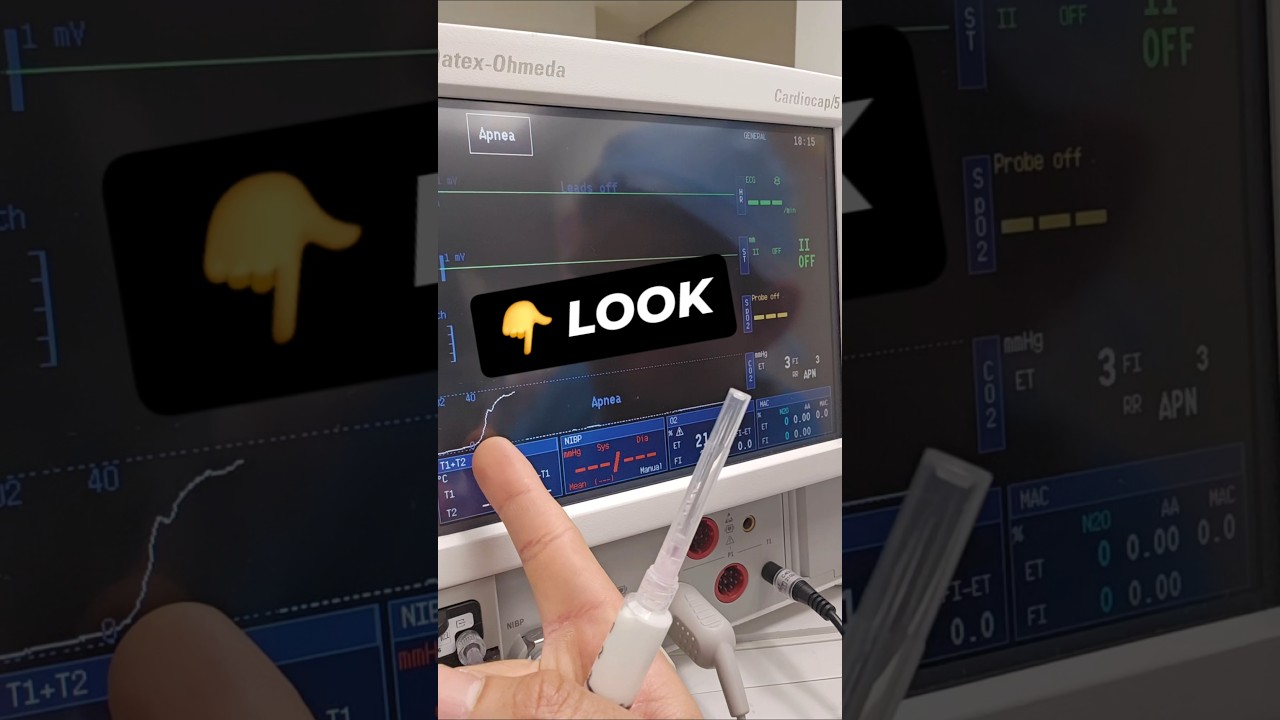 Signs you're WAKING UP in surgery